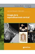 E-Book Cirugía De La Espondiloartrosis Cervical (Ebook)