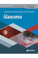 E-Book Glaucoma (Ebook)