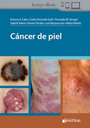 Dubois' Lupus Erythematosus and Related Syndromes por Hahn