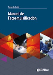 E-Book Manual De Facoemulsificación (Ebook)