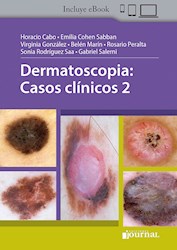 Papel Dermatoscopia: Casos Clínicos 2