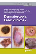 Papel Dermatoscopia: Casos Clínicos 2