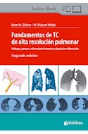 E-Book Fundamentos De Tc De Alta Resolución Pulmonar Ed.2 (Ebook)