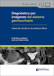 E-Book Diagnóstico Por Imágenes Del Sistema Genitourinario (Ebook)