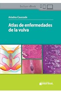 Papel Atlas De Enfermedades De La Vulva