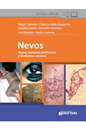E-Book Nevos (Ebook)