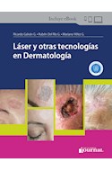 E-Book Láser Y Otras Tecnologías En Dermatología (Ebook)
