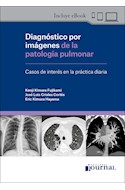 E-Book Diagnóstico Por Imágenes De La Patología Pulmonar (Ebook)