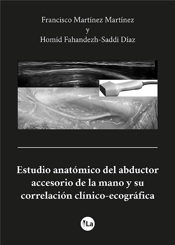 E-book Estudio Anatómico Del Abductor Accesorio De La Mano Y Su Correlación Clínico-Ecográfica