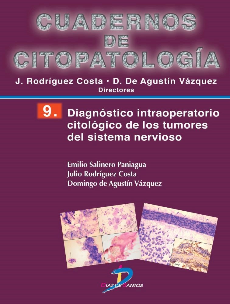 E-book Diagnóstico Intraoperatorio Citológico De Los Tumores Del Sistema Nervioso