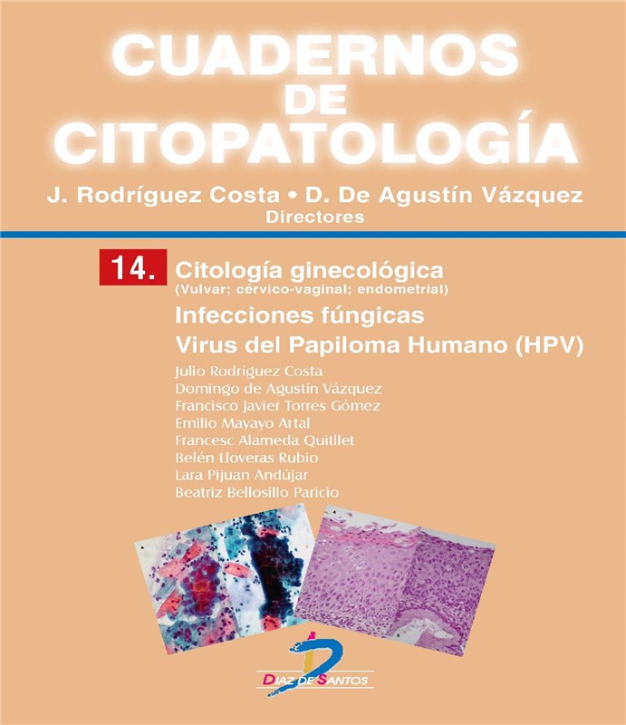 E-book Citología Ginecológica. Infecciones Fúngicas. Virus Del Papiloma Humano