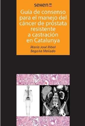 E-book Guía De Consenso Para El Manejo Del Cáncer De Próstata Resistente A Castración En Catalunya