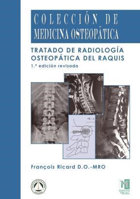 E-book Tratado De Radiología Osteopática Del Raquis