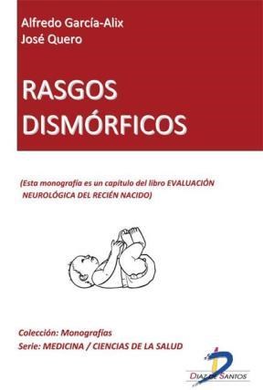 E-book Rasgos Dismórficos