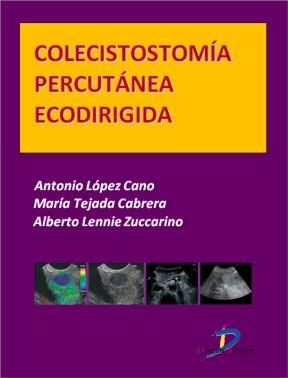 E-book Colecistostomía Percutánea Ecodirigida