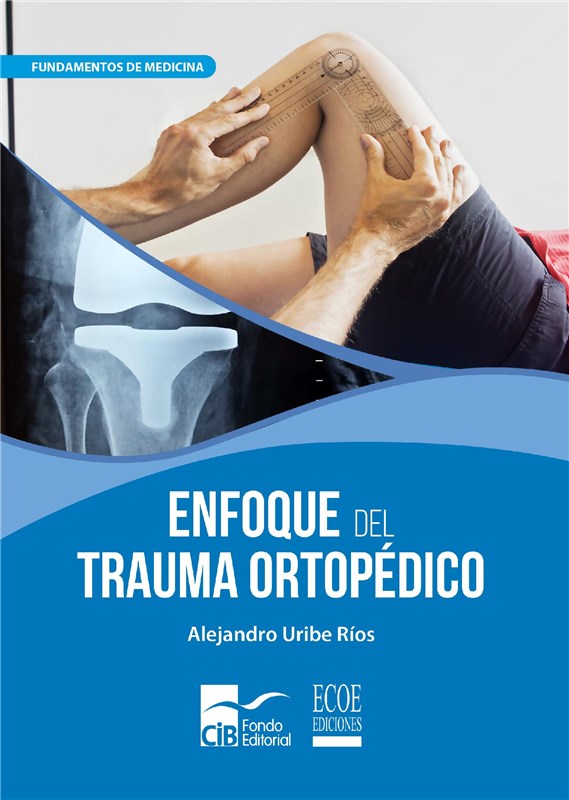 E-book Enfoque Del Trauma Ortopédico