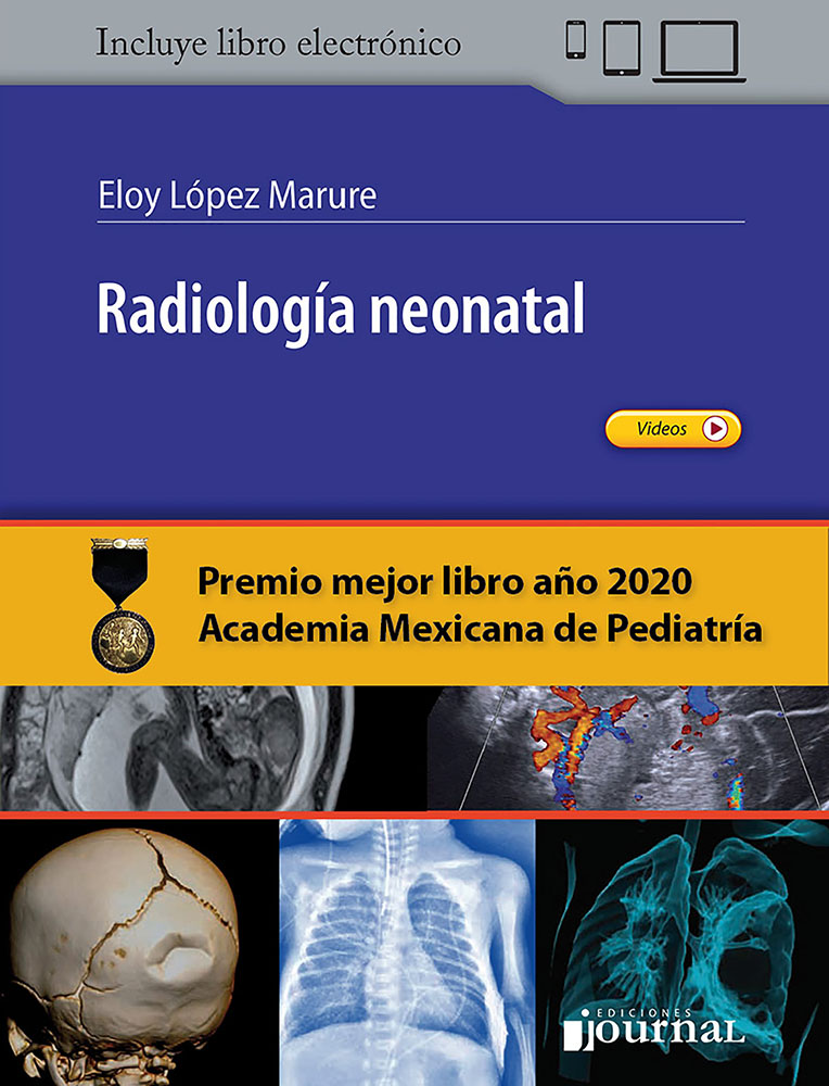 Papel Radiologia Neonatal